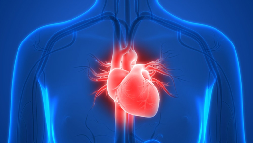 Heart implantation